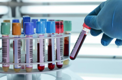 Read more about the article Understanding the Importance of Regular Blood Tests for Your Health