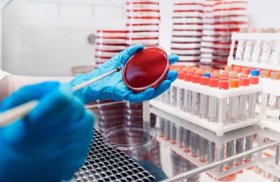 Read more about the article What is Blood Culture Test and when to take it