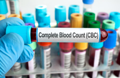 Read more about the article What Do You Need To Know About The CBC Test