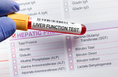 Read more about the article A Short Guide to The Liver Function Test (LFT)